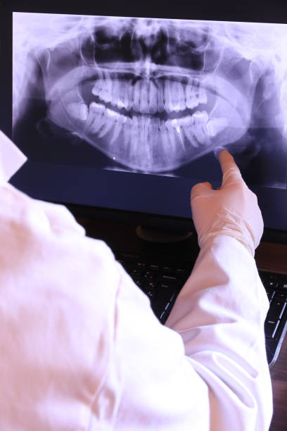 Best Emergency Wisdom Teeth Removal in Holiday City South, NJ